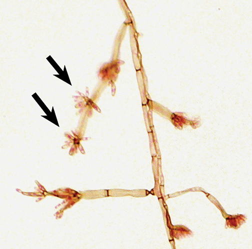 From Fig. 96-3. Pattern of conidiation of Fonsecaea pedrosoi. Arrows indicate asterisk conidiation.
