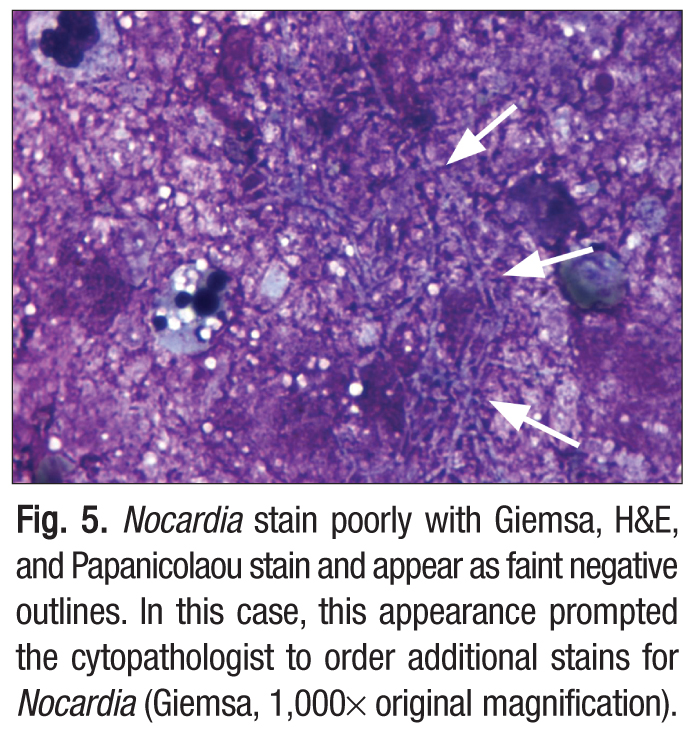 A further specification is that some yeasts, such as C. neoformans ...